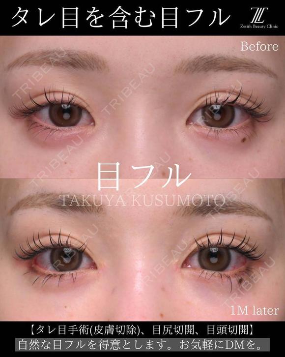 タレ目を含む目フル before画像 メイン用