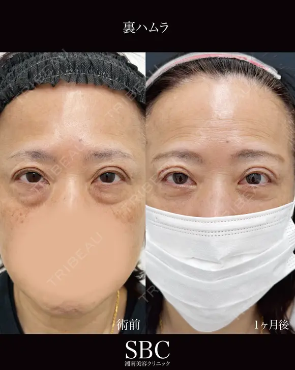 裏ハムラ before画像 メイン用