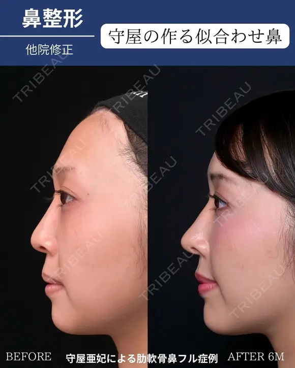 自然な垢抜けで可愛さアップデート 180日後 メイン用
