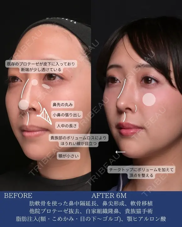 自然な垢抜けで可愛さアップデート 180日後 メイン用