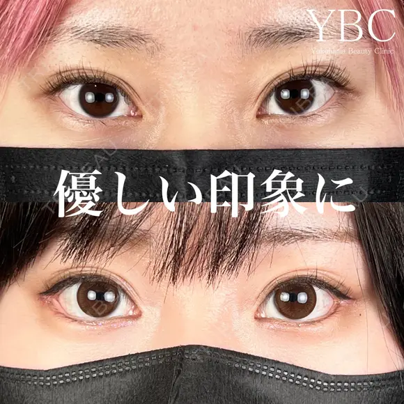 【優しい印象のお目元へ👼】 after画像 メイン用