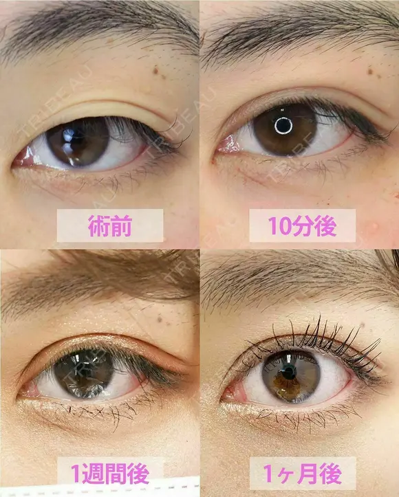 ✨クイックコスメティーク・ダブル✨ before画像 メイン用