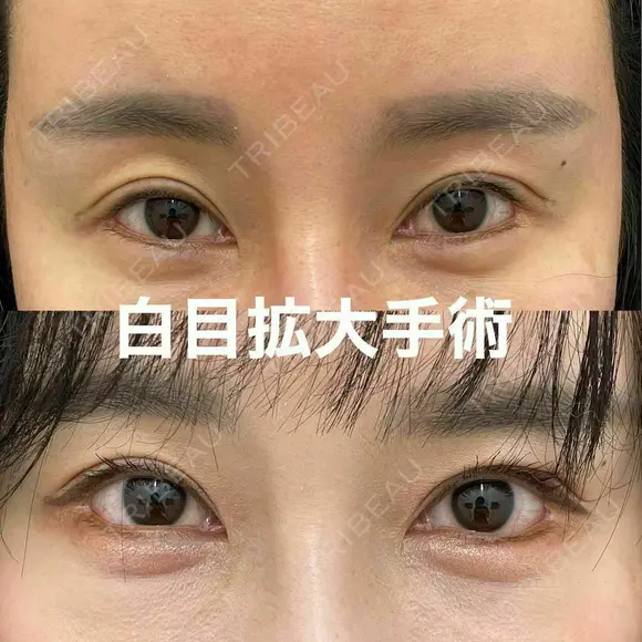 ✨魅力あふれる目✨の複合術 30日後 メイン用