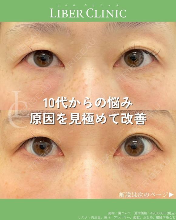 10代からの悩み 原因を見極めて改善 after画像 メイン用