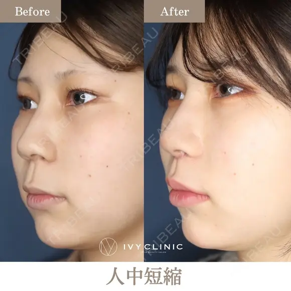 人中短縮 before画像 メイン用