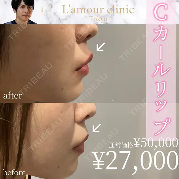 Cカールリップ after画像 メイン用