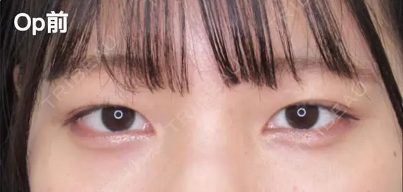 埋没法二重 before画像 メイン用