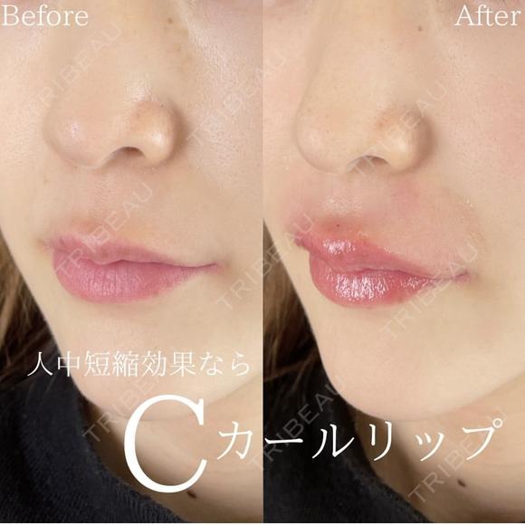 Cカールリップ after画像 メイン用