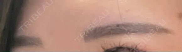 アートメイク（眉） ミケイ医院 DAY 10 メイン用