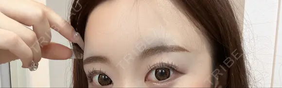 アートメイク（眉） 東京イセアクリニック DAY 3 メイン用