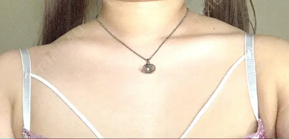 ボトックス（肩） ルラ美容クリニック 横浜院 AFTER メイン用