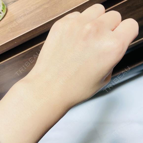 白玉点滴・注射 美容皮膚科エルムクリニック 京都院 AFTER メイン用