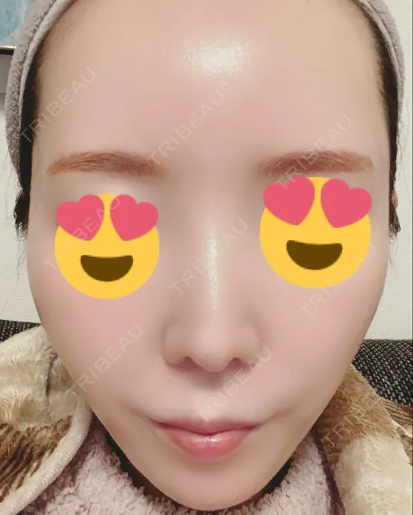 ルメッカ 豊洲内科・糖尿病 / 形成・美容外科クリニック AFTER メイン用