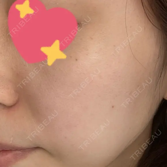 ルメッカ BIANCA表参道 DAY 3 メイン用