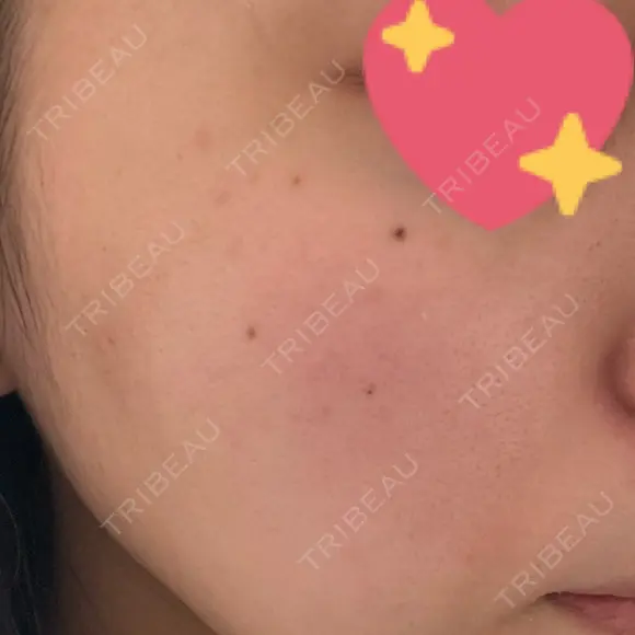 ルメッカ BIANCA表参道 DAY 4 メイン用