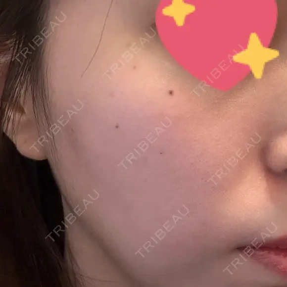 ルメッカ BIANCA表参道 DAY 5 メイン用