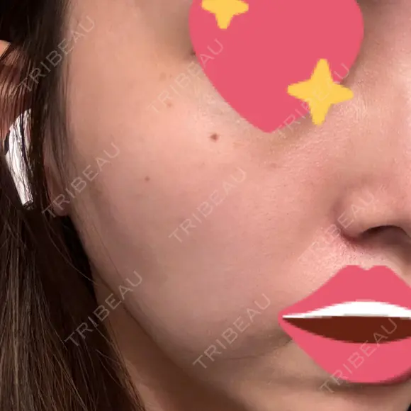 ルメッカ BIANCA表参道 DAY 21 メイン用