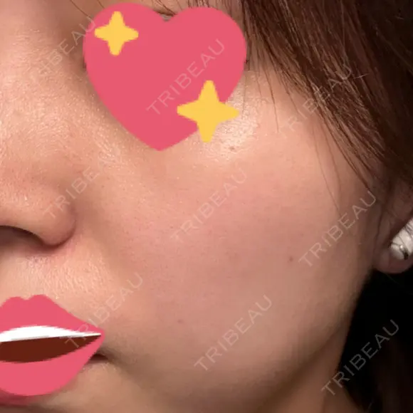 ルメッカ BIANCA表参道 DAY 21 メイン用