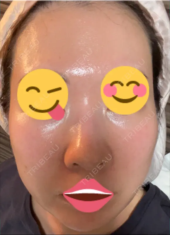 ポテンツァ 9BeautyClinic DAY 9 メイン用