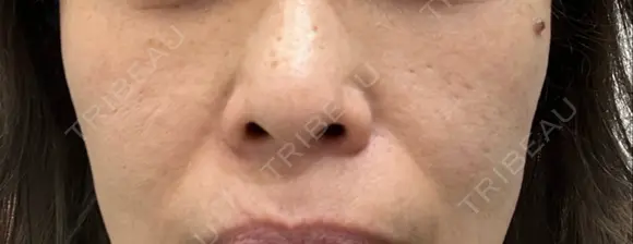 ポテンツァ 表参道メディカルクリニック 銀座院 DAY 0 メイン用