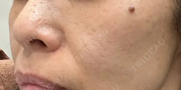 ポテンツァ 表参道メディカルクリニック 銀座院 DAY 0 メイン用