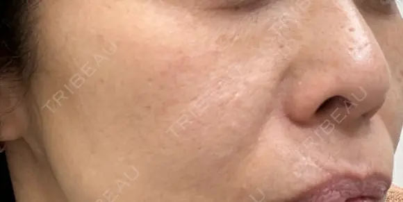 ポテンツァ 表参道メディカルクリニック 銀座院 DAY 0 メイン用