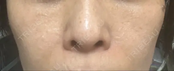 ポテンツァ 表参道メディカルクリニック 銀座院 DAY 1 メイン用