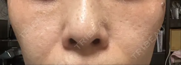 ポテンツァ 表参道メディカルクリニック 銀座院 DAY 2 メイン用