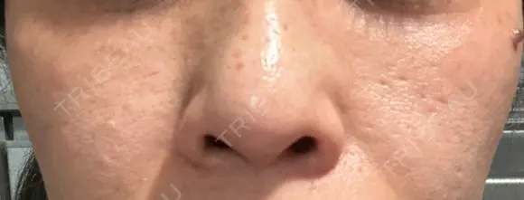 ポテンツァ 表参道メディカルクリニック 銀座院 AFTER メイン用