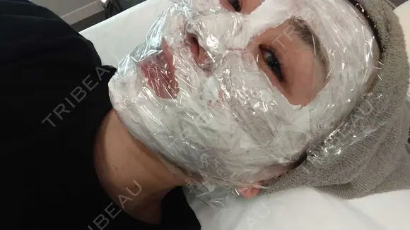 ポテンツァ 9BeautyClinic DAY 0 メイン用