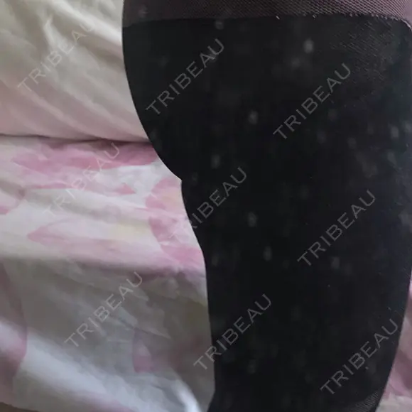 脂肪吸引（脚） / 脂肪吸引（お尻） ドクターフィット（Dr.fit）クリニック DAY 43 メイン用