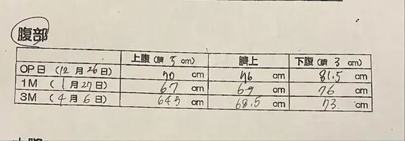 脂肪吸引（お腹） オアシス美容外科 DAY 102 メイン用