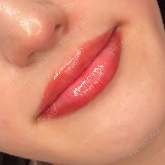 アートメイク（唇） Brandnew Beauty Clinic AFTER メイン用