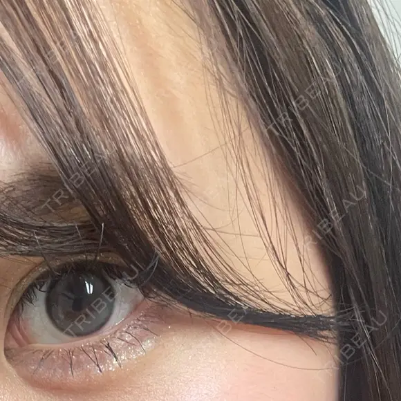 ヒアルロン酸注入（涙袋） ファイヤークリニック 銀座院 DAY 4 メイン用