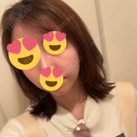 ピコレーザートーニング（美白・肝斑） / レーザートーニング（美白・肝斑） ルラ美容クリニック 渋谷本院 DAY 7 メイン用