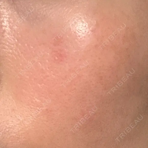 その他（肌） YAYOI CLINIC DAY 2 メイン用