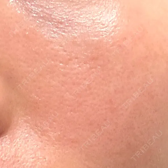 その他（肌） YAYOI CLINIC AFTER メイン用