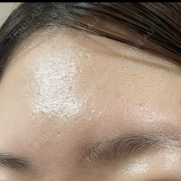 ポテンツァ DAILY SKIN CLINIC 福岡院 DAY 5 メイン用