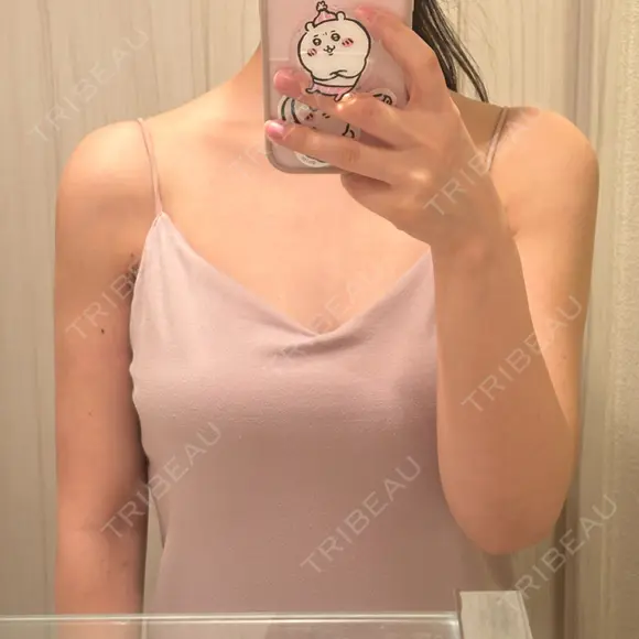 脂肪吸引（二の腕） 湘南美容クリニック 京都院 DAY 31 メイン用