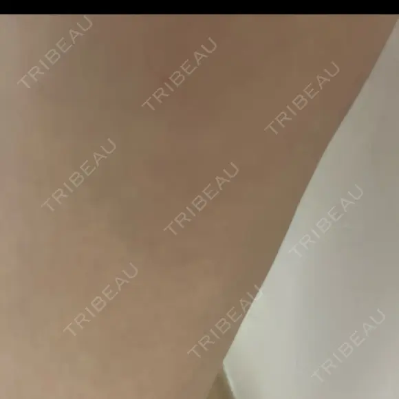 脂肪吸引（脚） / ボトックス（ふくらはぎ） THE CLINIC（ザ・クリニック） 福岡院 DAY 16 メイン用