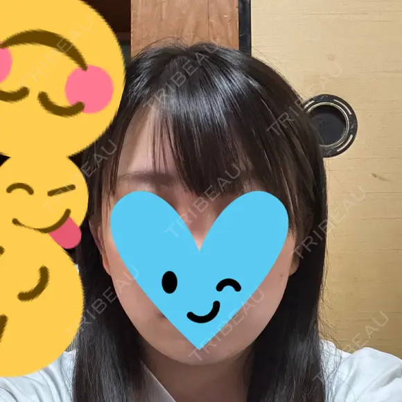 ボトックス（エラ・小顔） TCB東京中央美容外科 佐賀院 AFTER メイン用