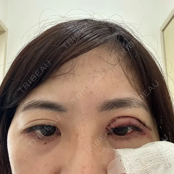 二重切開 / 傷跡修正 / 肌ヒアルロン酸注入（たるみ・シワ改善） / 美肌レーザー / シミ取りレーザー 石倉クリニック 水戸院 DAY 1 メイン用