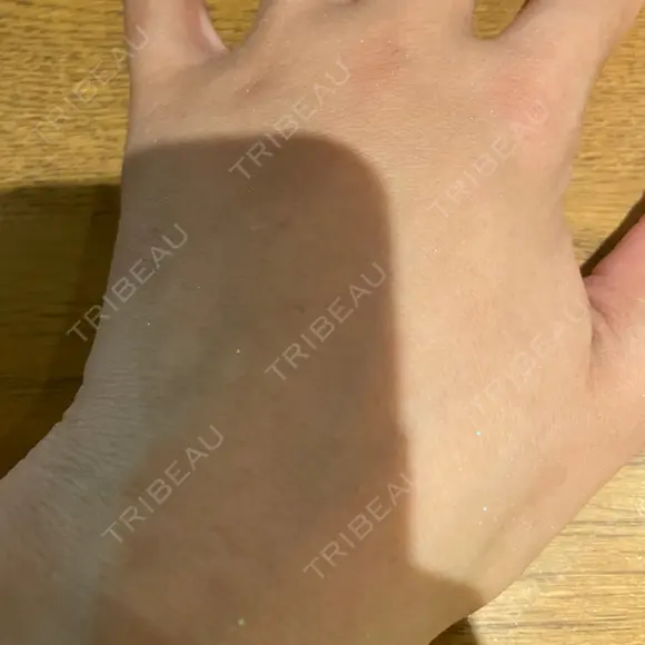 脂肪注入（肌） EMMO FACE CLINIC 大阪梅田院 DAY 6 メイン用