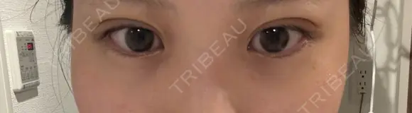二重埋没 シンデレラ＆ダヴィンチクリニック DAY 3 メイン用