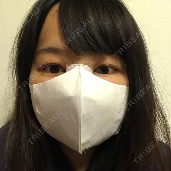 隆鼻術 / 鼻尖形成（切開） / 軟骨移植 / ワシ鼻修正・ハンプ切除 / 鼻尖縮小 表参道スキンクリニック 表参道院 DAY 3 メイン用