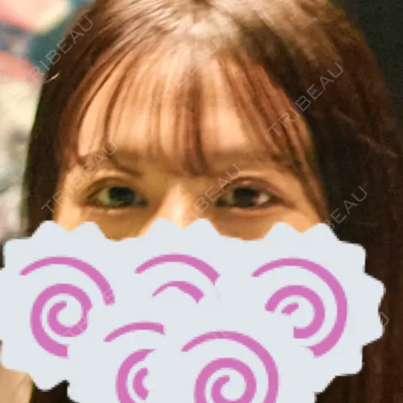 二重埋没 BELINDA CLINIC（ベリンダクリニック）新宿院 DAY 58 メイン用
