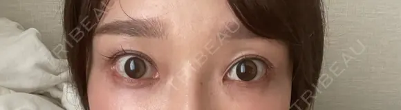 スネコス お肌のクリニック　高田馬場 DAY 8 メイン用