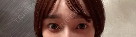 スネコス お肌のクリニック　高田馬場 DAY 13 メイン用