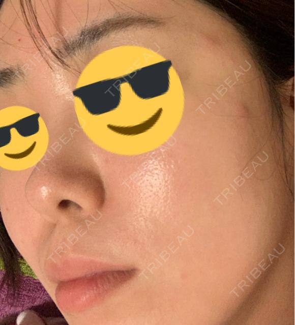 レーザーフェイシャル LIGHT CLINIC 【ライトクリニック】 新宿院 DAY 0 メイン用