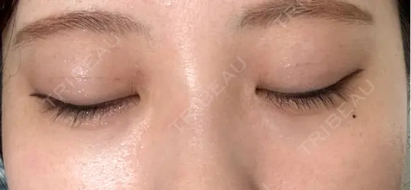 二重埋没 シンデレラ＆ダヴィンチクリニック DAY 31 メイン用